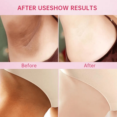 Bleaching Whitening Cream